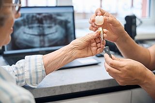 dental implants.jpg