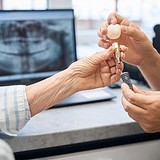 dental implants