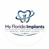 Dental Implants Jupiter.jpg