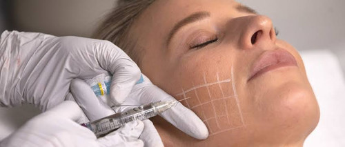 Best Skin Boosters in Marlow.jpg