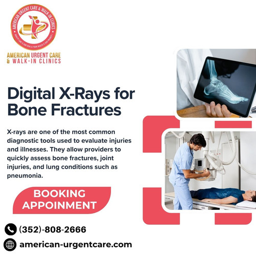 digital x rays for bone fractures.jpg