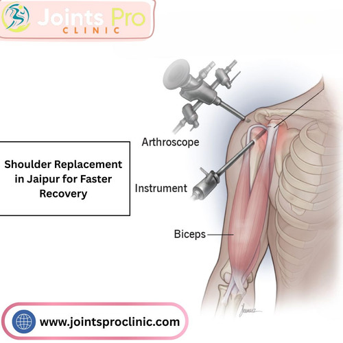 Shoulder Replacement in Jaipur for Faster Recovery.jpg