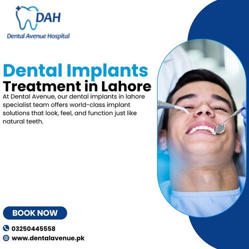 dental implants treatment in lahore.jpg