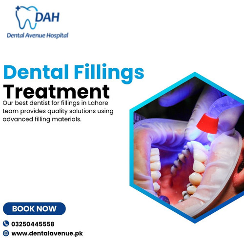 dental fillings treatment lhr.jpg
