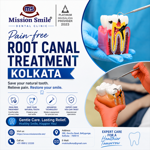 Pain-free Root Canal Treatment Kolkata by Mission Smile Dental Clinic.png