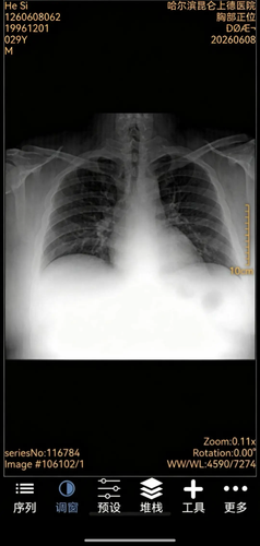 xray.png