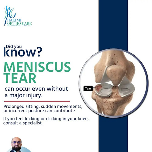 Understanding Meniscus Tears Causes and Symptoms.jpg