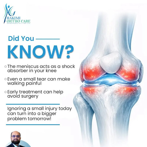 The Importance of Early Treatment for Meniscus Injuries.jpg