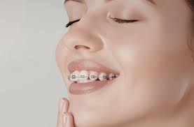 Natomas Invisalign.jpg