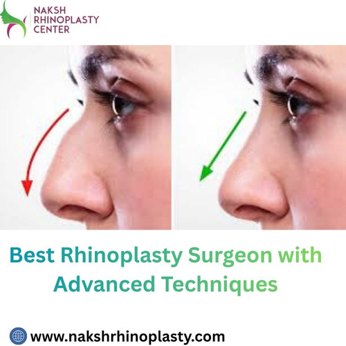 Best Rhinoplasty Surgeon with Advanced Techniques.jpg