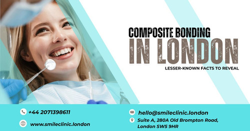 Composite Bonding in London Lesser Known Facts to Reveal.jpg