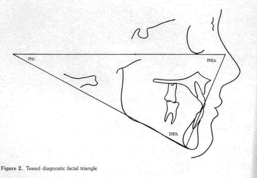193bcea89156.png