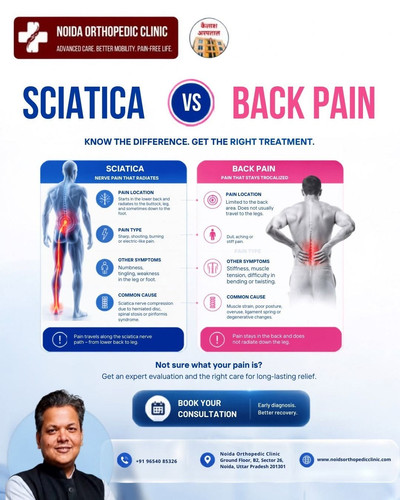 Sciatica vs Back Pain How to Identify the Right Condition.jpg