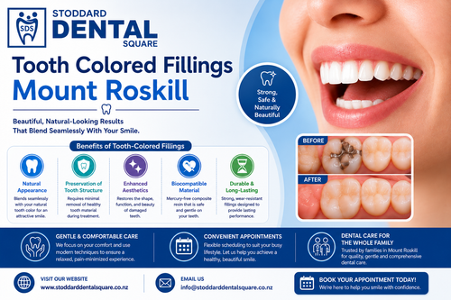 Tooth Colored Fillings Mount Roskill.png