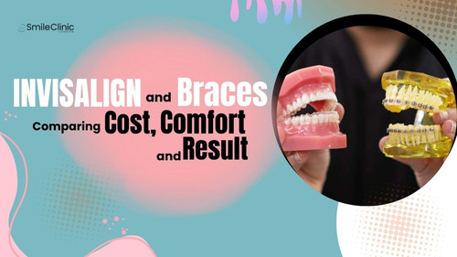 Invisalign and Braces Comparing Cost, Comfort and Result.jpg