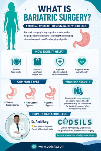 What Is Bariatric Surgery?.png