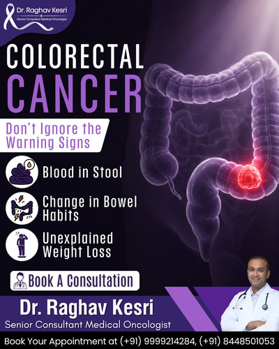 Best Oncologist in Greater Noida Dr Ragav Kesri.jpg