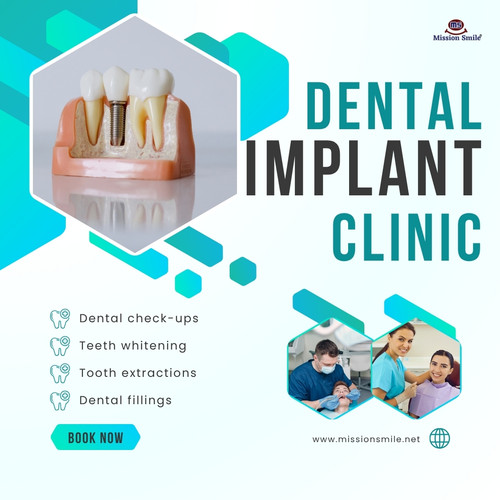 Experience Premium Expert Dental Implant Services in Kolkata Today.jpg