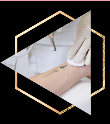Scar Camouflage Permanent Makeup.png
