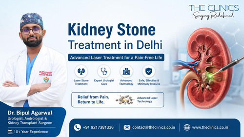 𝐊𝐢𝐝𝐧𝐞𝐲 𝐒𝐭𝐨𝐧𝐞 𝐓𝐫𝐞𝐚𝐭𝐦𝐞𝐧𝐭 𝐢𝐧 𝐃𝐞𝐥𝐡𝐢 | 𝐀𝐝𝐯𝐚𝐧𝐜𝐞𝐝 𝐋𝐚𝐬𝐞𝐫 𝐒𝐭𝐨𝐧e.jpg
