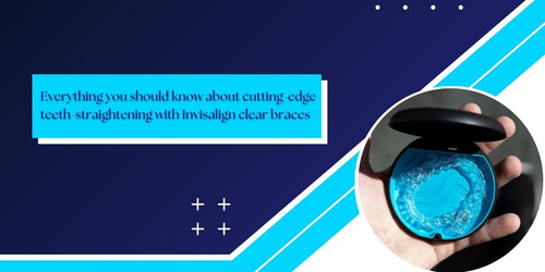 Everything you should know about cutting edge teeth straightening with Invisalign clear braces.jpg