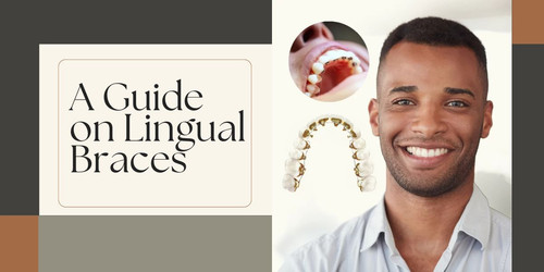 A Guide on Lingual Braces.jpg