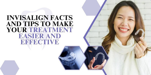Invisalign facts and tips to make your treatment easier and effective.jpg