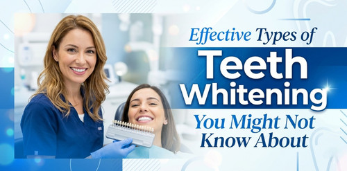 Effective Types of Teeth Whitening You Might Not Know About.jpg