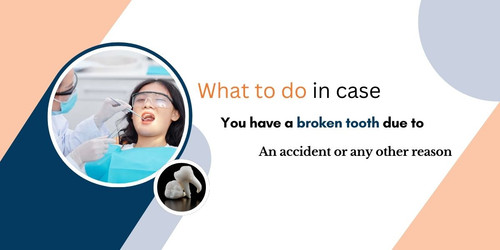 What to do in case you have a broken tooth due to an accident or any other reason.jpg