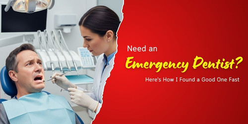 Need an Emergency Dentist Here's How I Found a Good One Fast.jpg