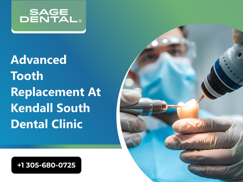 Advanced Tooth Replacement at Kendall South Dental Clinic.jpg