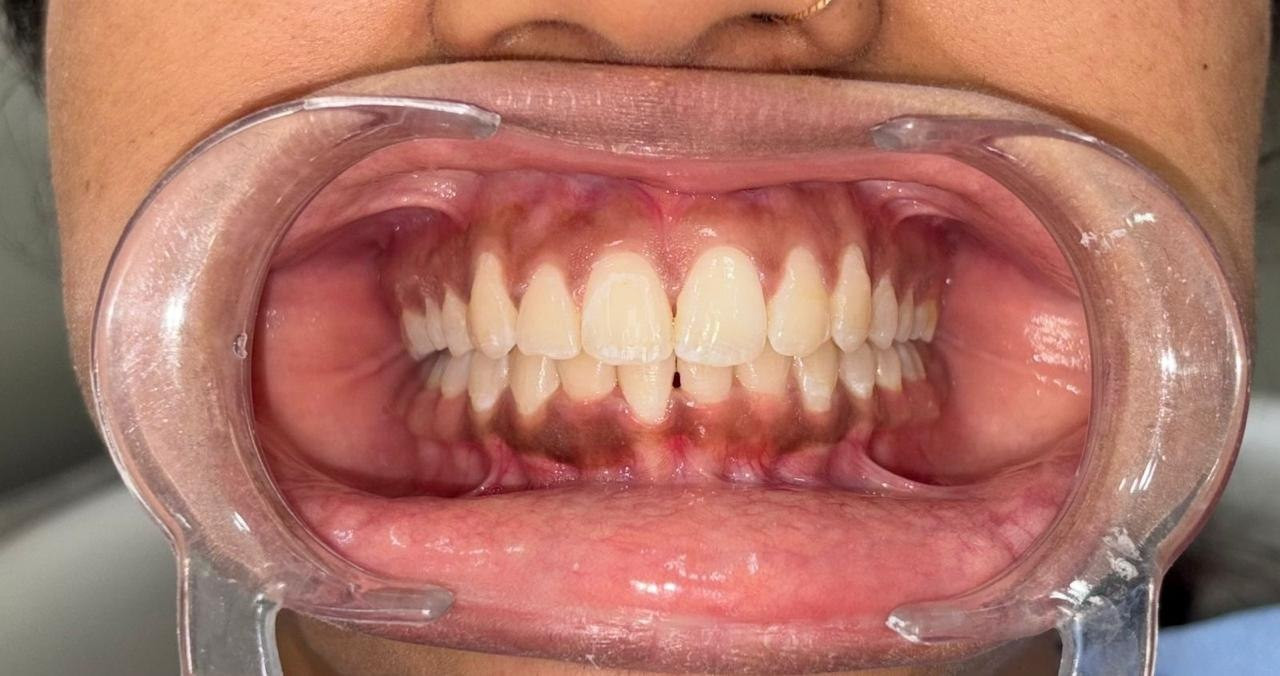 Dental Care 8