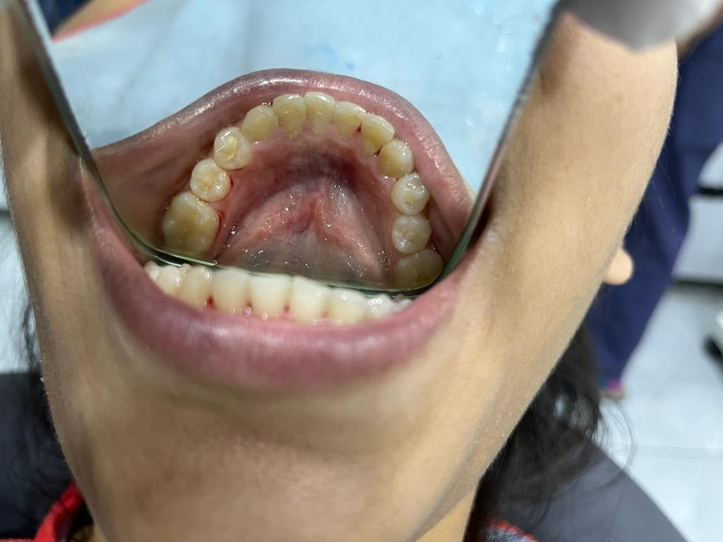 Dental Care 7