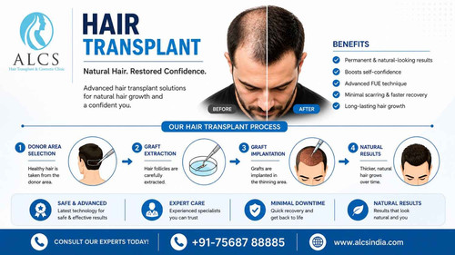 Hair-transplan.jpg
