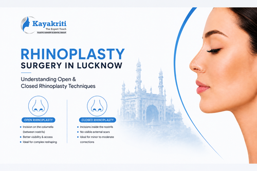 Rhinoplasty Surgery in Lucknow, India Kayakriti Clinic India.png