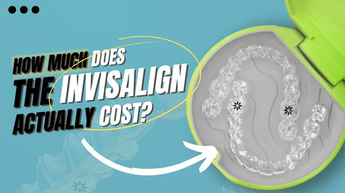How Much Does the Invisalign Actually Cost An Intensive Guide.jpg