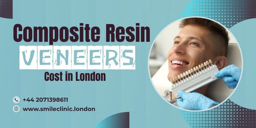 Composite Resin Veneers Cost in London – Smile Makeovers.jpg