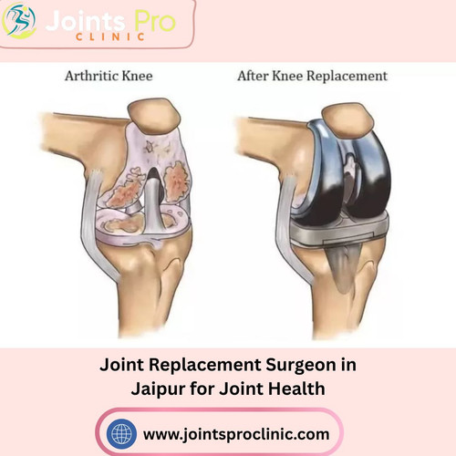 Joint Replacement Surgeon in Jaipur for Joint Health.jpg
