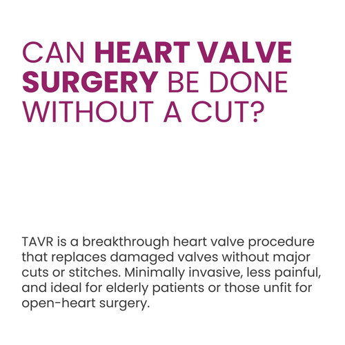 TAVR.jpg