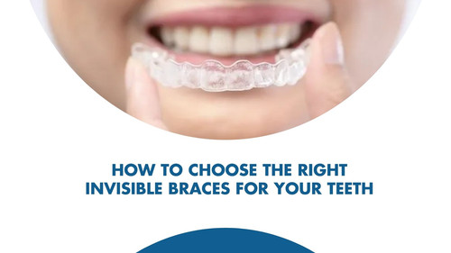 How to Choose the Right Invisible Braces for Your Teeth.jpg