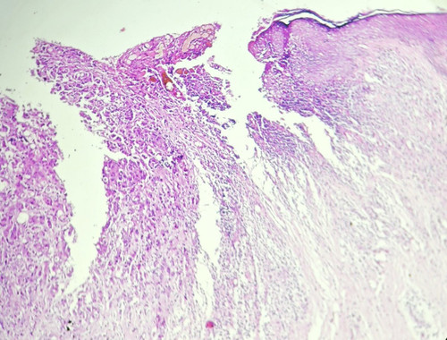 Gs1035la4AA4nf3.jpg