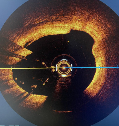 GszUIA7bIAAs Zy?format=jpg.jpg