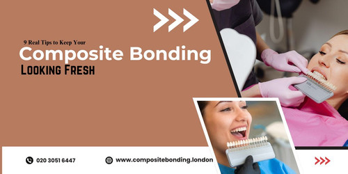 9 Real Tips to Keep Your Composite Bonding Looking Fresh.jpg