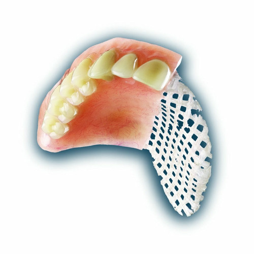 Flexible Partial Dentures.jpg