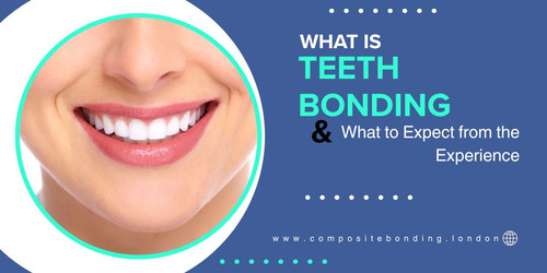 What Is Teeth Bonding and What to Expect from the Experience.jpg