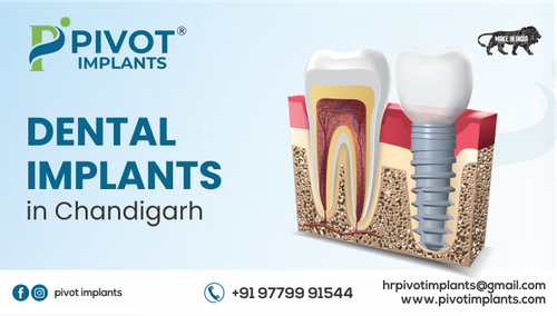 Dental Implants in Chandigarh.png