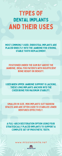Types of Dental Implants and Their Uses.jpg