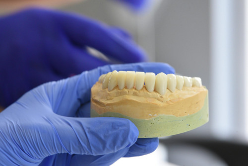 Dental Inlays San Mateo.jpg