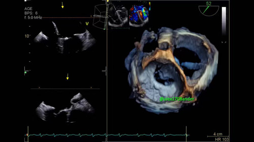 L8 XO1CSVtZ2GpT3.jpg