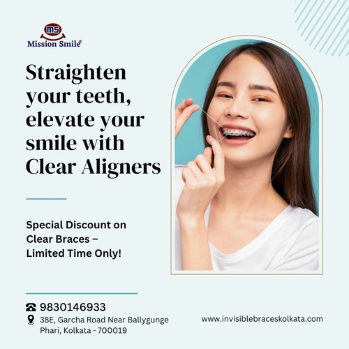 Your Dream Smile Starts with Clear Aligners in Kolkata.jpg
